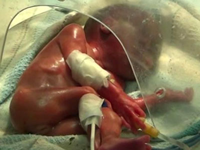 Bé sơ sinh “sống lại” sau khi bệnh viện xác nhận đã chết