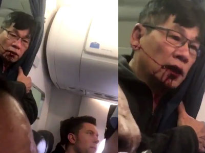 Clip gây sốc: Bác sĩ châu Á mặt đầy máu liên tục nói "Giết tôi đi" khi bị nhân viên hãng hàng không Mỹ thô bạo lôi khỏi máy bay