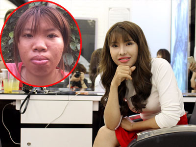 HOT: Hình ảnh nhan sắc hoàn thiện sau phẫu thuật thẩm mỹ của Phượng "Thị Nở tái sinh"