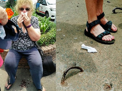 Ông Đoàn Ngọc Hải giải thích lý do bồi thường du khách ngã "vỡ mặt" trên phố