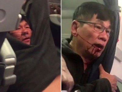 Luật sư: "David Dao bị choáng, gãy mũi và răng"