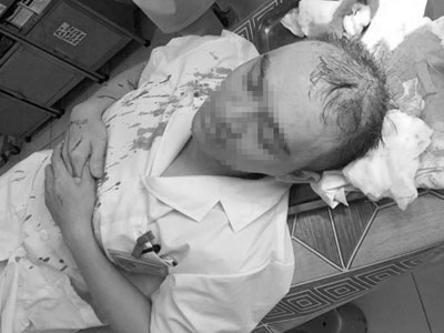 Hà Nội: Bác sĩ bị đánh bất tỉnh, theo dõi chấn thương sọ não