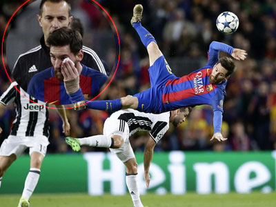 Messi ngã lộn cổ, đập mặt xuống sân và chảy máu