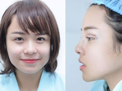 Thái Trinh thừa nhận sửa mũi, cắt mí để cải thiện nhan sắc