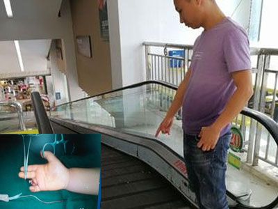 Tai nạn thang cuốn kinh hoàng, bé 1 tuổi bị kẹp đứt ngón tay