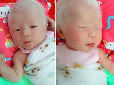 Sinh con da trắng như "trứng gà bóc", mẹ đau lòng khi phát hiện ra sự thật