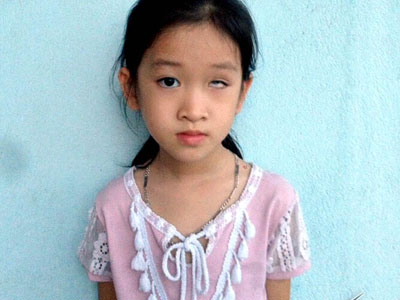 Trò lớp 1 bị phi thước kẻ mù mắt, nhà trường đứng ngoài