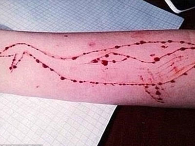Hơn 100 bạn trẻ chết vì trào lưu "Cá voi xanh" trên Facebook