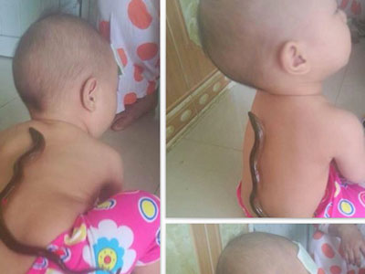 Hạ sốt bằng lươn, lươn chết trên lưng trẻ: Lời khuyên của PGS.TS Nguyễn Tiến Dũng