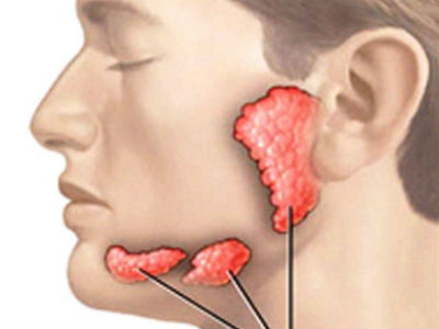 Xuất hiện dấu hiệu này bạn nên nghĩ đến ung thư tuyến nước bọt