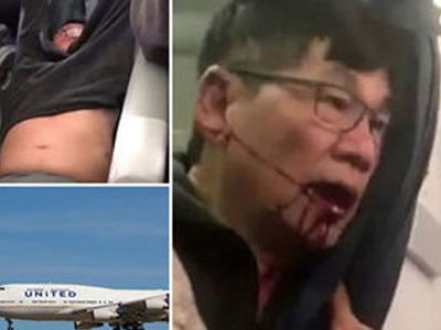 United Airlines phải trả bao nhiêu cho sự im lặng từ bác sĩ Dao?