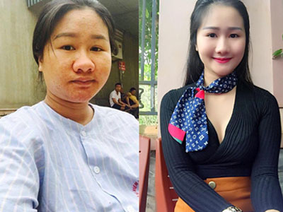 Bà bầu xấu "hiếm có khó tìm" đẹp mơn mởn khi giảm 32kg