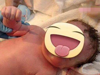 Sự cố cười ra nước mắt, em bé đẻ ra tay vẫn cầm chặt chiếc vòng tránh thai