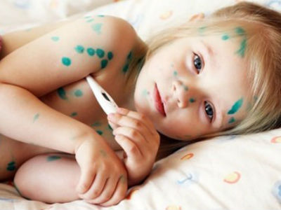 3 bệnh nguy hiểm dễ mắc vào mùa hè
