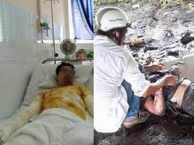 Chủ xe phân khối lớn bốc cháy trên QL 1A nguy cơ nhiễm trùng cao do nhảy xuống vũng sình