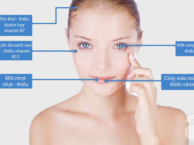 5 dấu hiệu trên mặt tố cáo bạn đang thiếu vitamin trầm trọng