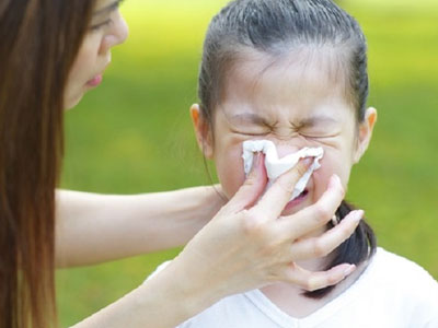 Trẻ bị chảy máu cam: Tại sao không cho con ngả đầu về phía sau?