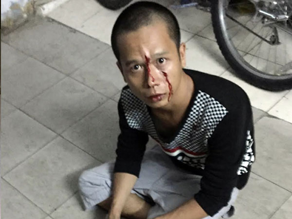 Tên cướp bị bắt vì kẹt xe ở Sài Gòn