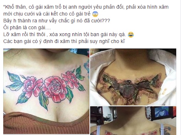Sự thật về cô gái xăm hình nhận hậu quả kinh hoàng vì người yêu bắt xóa xăm mới chịu cưới