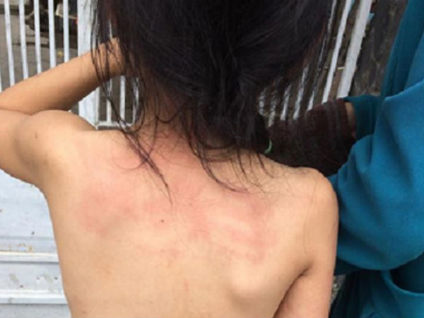 Sự thật bé gái lớp 3 bị bố mẹ lột trần, đánh đuổi ra khỏi nhà vì nhớ nhầm lịch thi