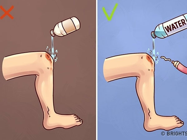 Mẹo sơ cứu đơn giản nhưng 90% người làm sai khi khẩn cấp