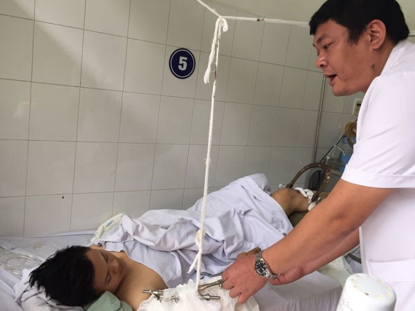 Nam sinh kiến trúc bị cửa xe khách kẹp đứt lìa cánh tay trên đường về quê