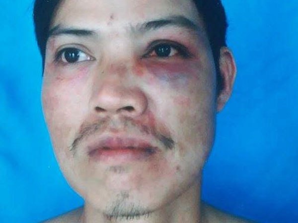 Người “tự đập đầu xuống bàn” tại CA phường tung tin thất thiệt?