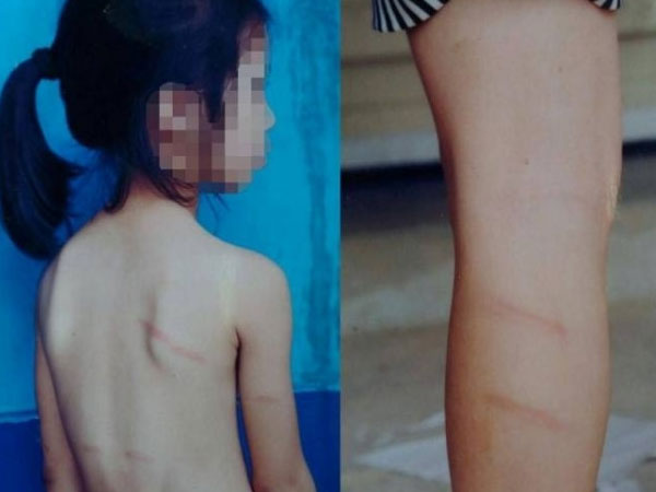 Học sinh lớp 1 không làm được bài tố bị cô giáo đánh