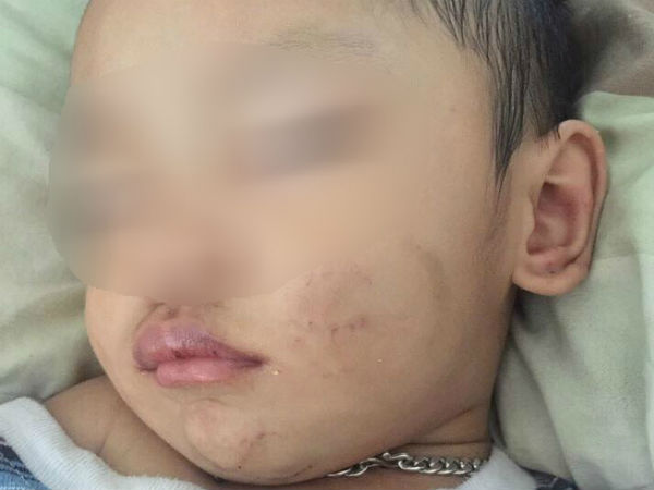 Bình Dương: Người mẹ trẻ tiếp tay cho chồng hờ, bạo hành con trai 2 tuổi phải nhập viện cấp cứu?
