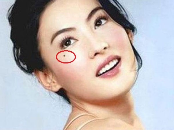 Nốt ruồi “Lệ Đường” ở phụ nữ, may mắn hay đau khổ một đời?