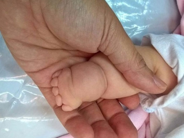 Tay chân bé có ngấn tưởng bụ bẫm, hóa ra bệnh lạ