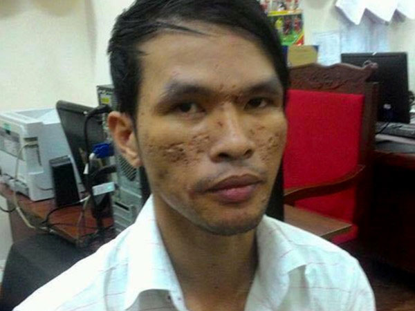 Kẻ hành hạ, chích điện bé trai Campuchia bị truy tố đến 3 năm tù