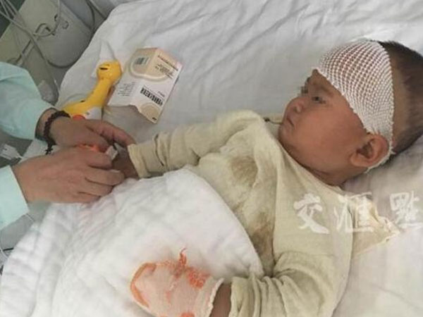 Bất mãn vì bị chồng bạo hành, mẹ cắn con 1 tuổi trọng thương