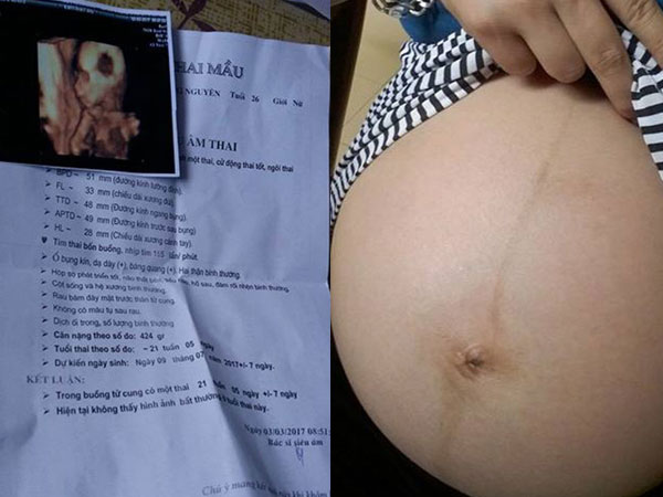 8 năm tủi nhục trước bao lời dè bỉu, cặp vợ chồng bất ngờ nhận cái kết ngọt lịm