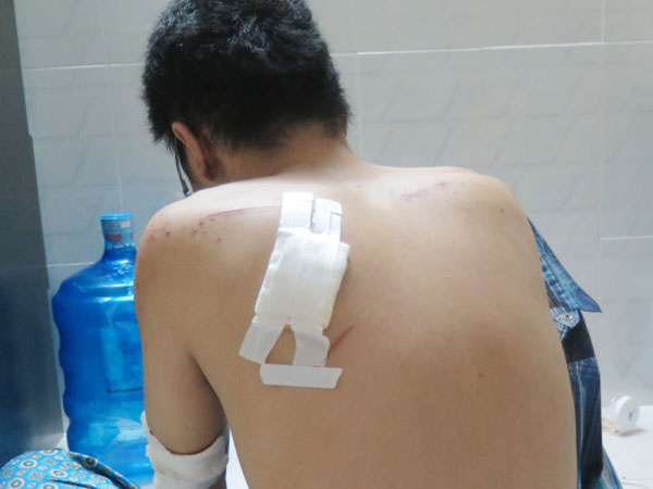 Cảnh sát điều tra băng cướp xe tay ga ở Sài Gòn