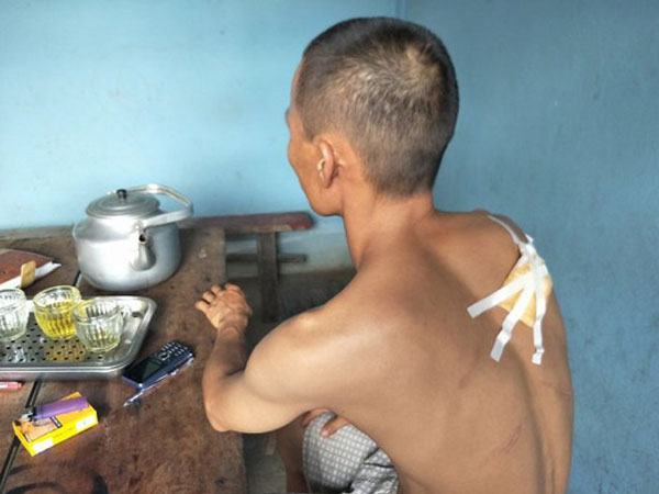 Bắt thanh niên chém dã man thợ xây đến lấy tiền công
