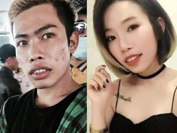 Thực hư hình ảnh "thẩm mỹ thành công" gây ồn ào của công chúa thủy tề Tùng Sơn