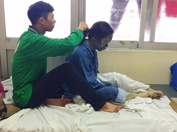 Bức ảnh dễ thương về chàng trai ngồi tết tóc cho người yêu bị thủy đậu: Yêu là luôn bên nhau cả khi xấu xí nhất