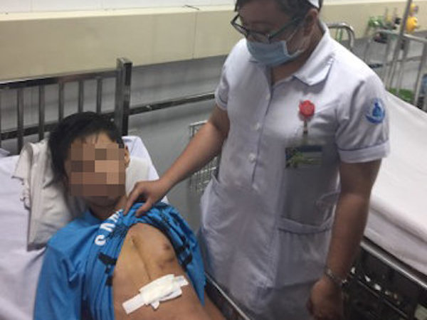 Lấy kim khâu trong tim một bé trai