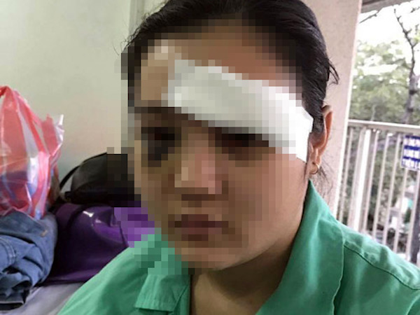 Khởi tố vụ án thiếu nữ bị nhóm côn đồ cắt tai