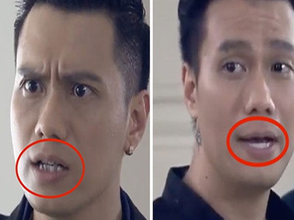 Tin được không: Cùng một tập phim "Người Phán Xử" mà Phan Hải có đến 2 bộ răng!