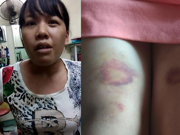 Chủ cửa hàng gội đầu đánh khách chấn thương sọ não