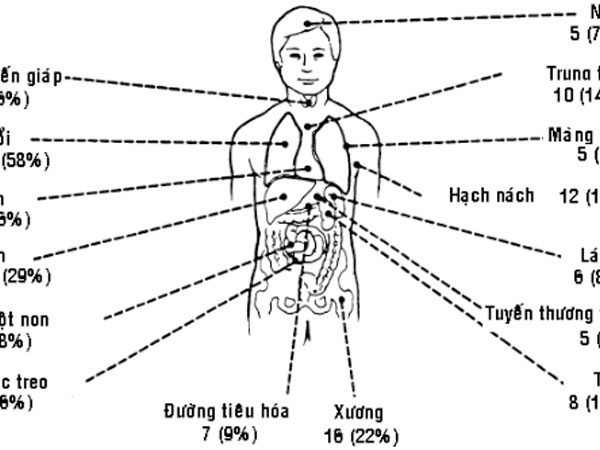 Thủ phạm gây ung thư amidan bạn cần tránh