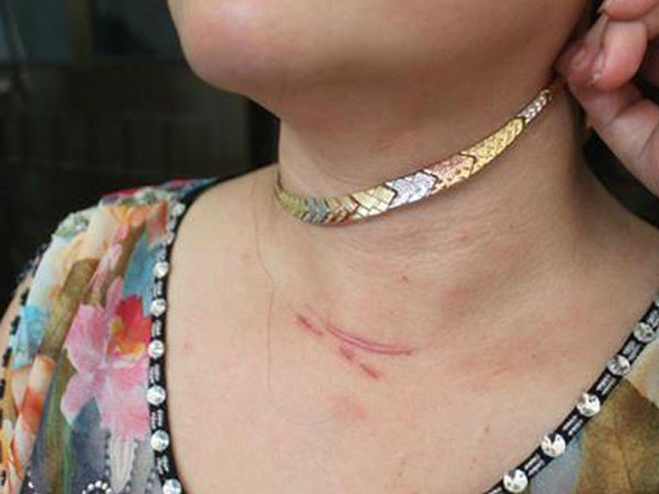 Nữ chủ nhà 29 tuổi bị bóp cổ, cướp dây chuyền vàng