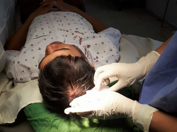 Bác sĩ bị người lạ tấn công rách đầu