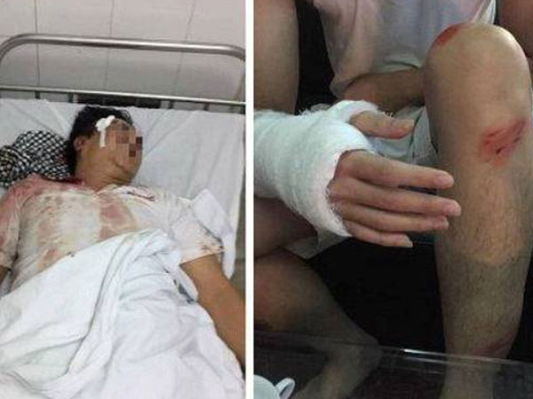 Côn đồ hành hung dã man lúc nửa đêm, 4 người ở Hà Nội nhập viện