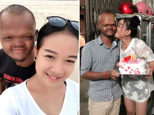 Ai mà tin nổi chàng trai xấu xí lại "cưa đổ" cô gái 18 tuổi xinh như hot girl thế này