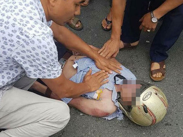 Nam thanh niên bị sét đánh trúng mặt khi đang đi đường: Tiên lượng xấu