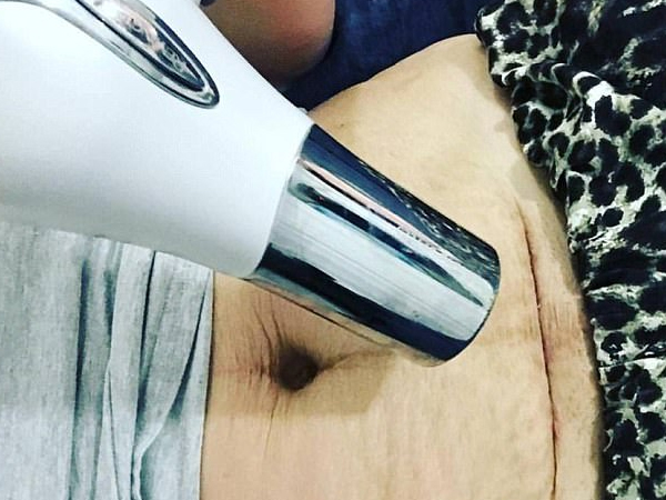 Người phụ nữ dùng máy sấy thổi vào vết mổ sau sinh, hiểu được công dụng này, mẹ nào sinh mổ cũng cần “giắt lưng”