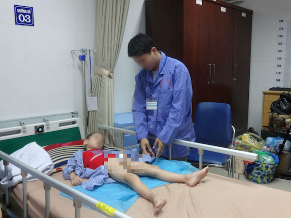 Sẽ điều trị miễn phí cho trẻ mắc sùi mào gà ở Hưng Yên